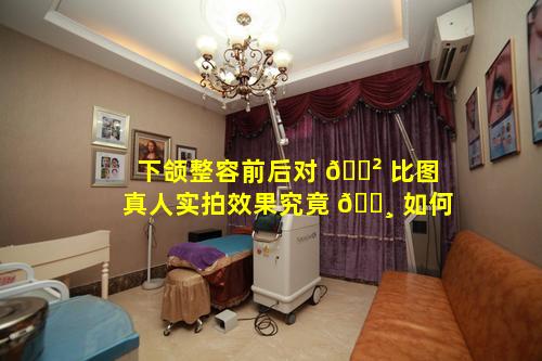 下颌整容前后对 🌲 比图真人实拍效果究竟 🕸 如何